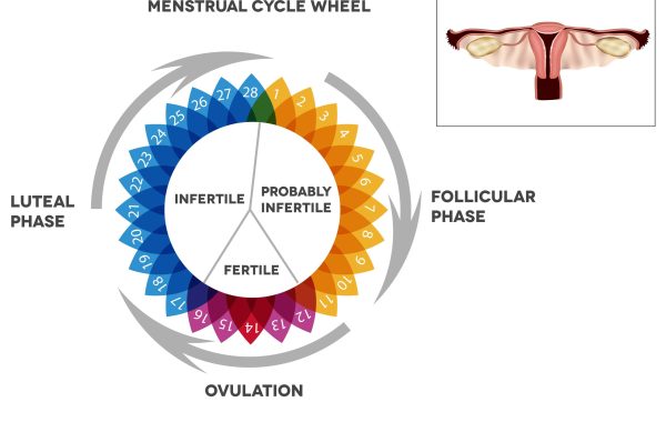 Luteal Phase Defect اختلال فاز لوتئال