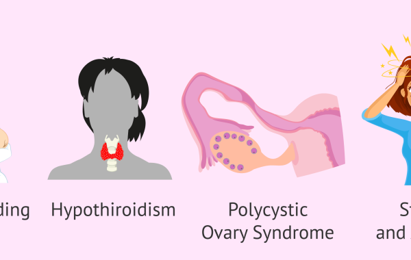 causes-of-hyperprolactinemia اختلالات تیروئید